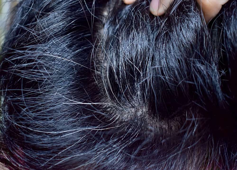 Rambut Beruban