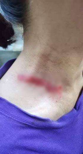 Kipas itu mengenai leher ibu temannya.