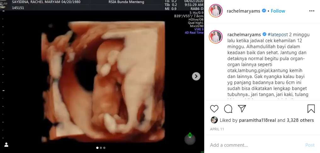 calon buah hati rachel Maryam yang kedua