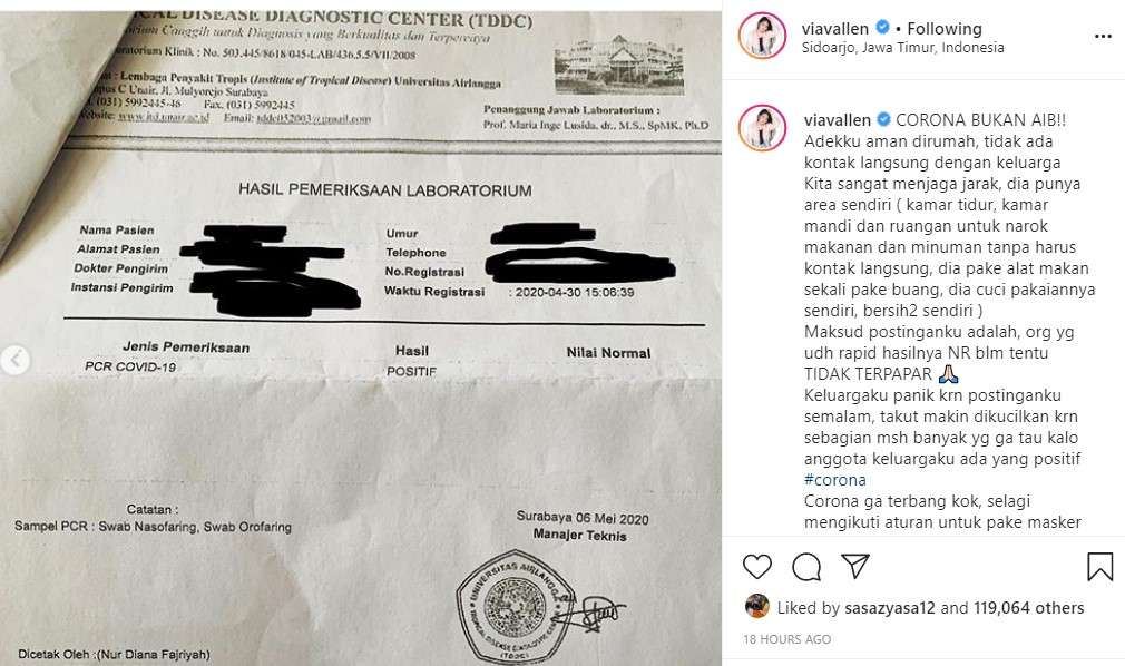 adik via vallen posotif corona