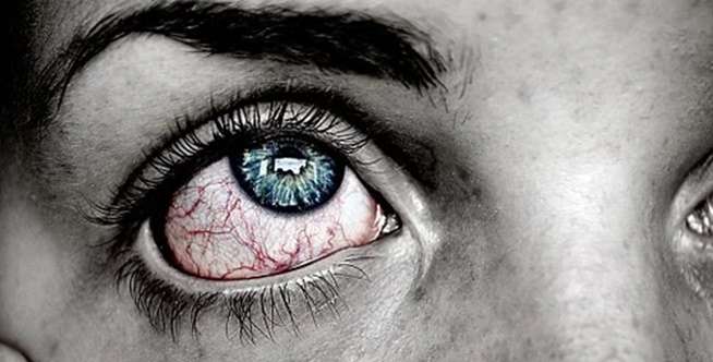 Ilustrasi