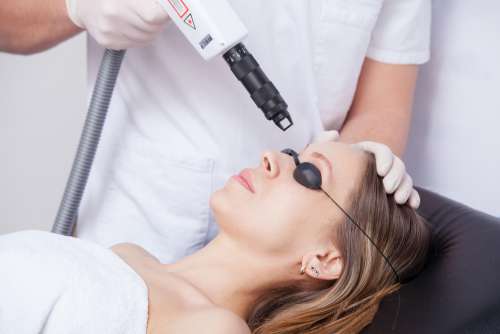 Acne Laser Acne Laser
