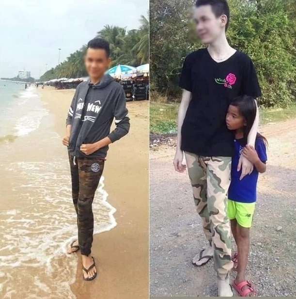 Efek Krim Pemutih