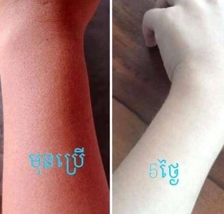 Efek Krim Pemutih