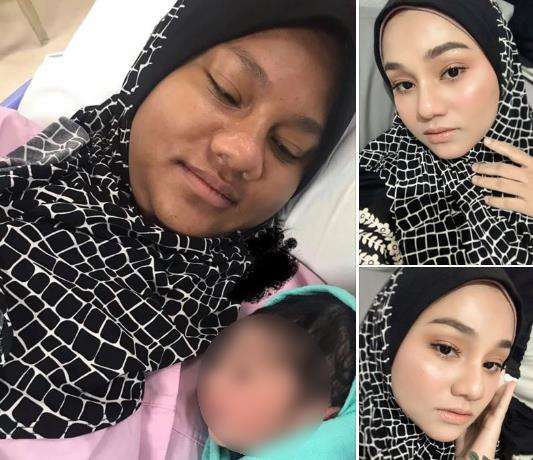 Perbandingan wajah Amma saat melahirkan dan sesudahnya.
