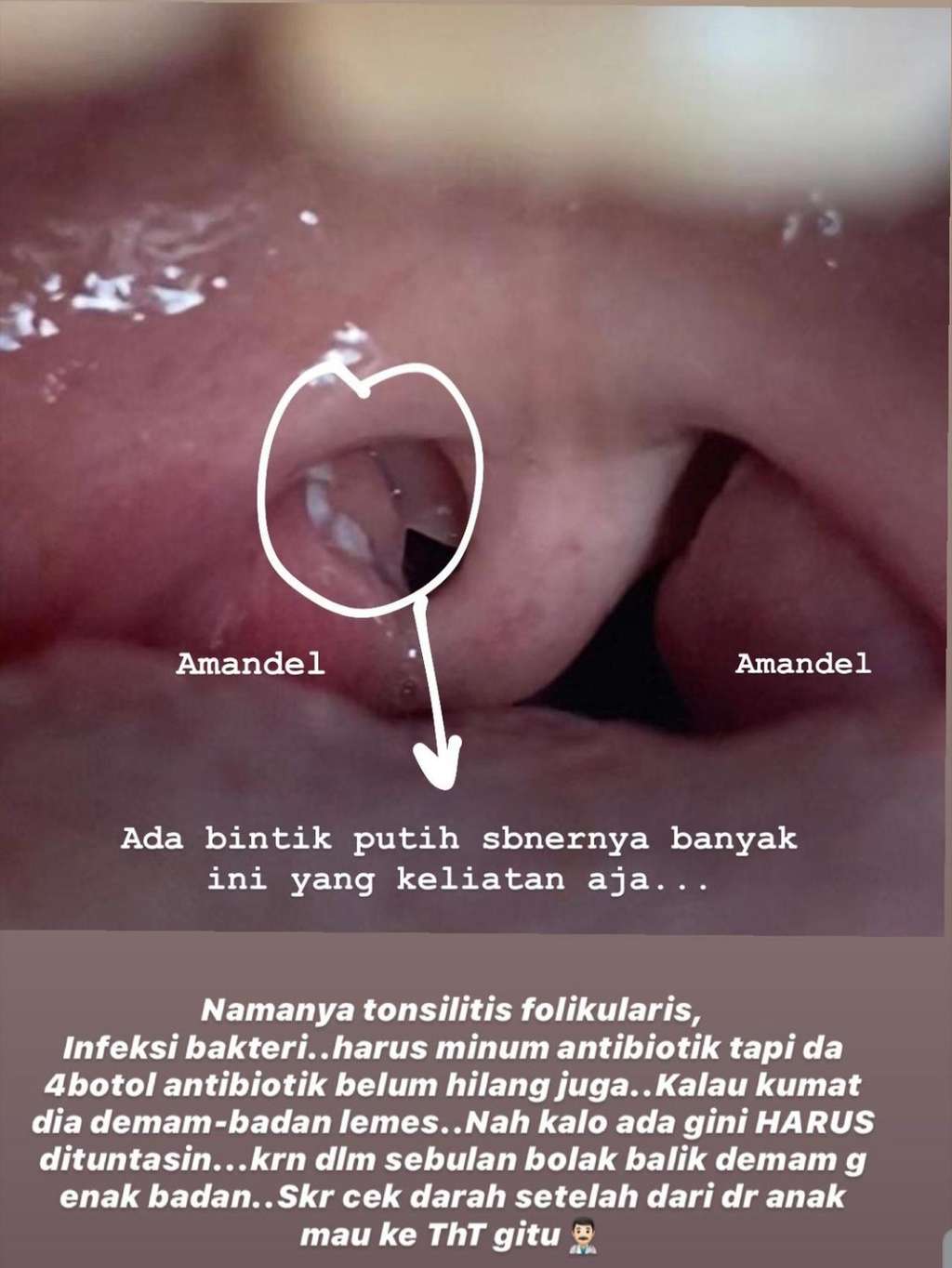 Putri Zaskia dan Hanung