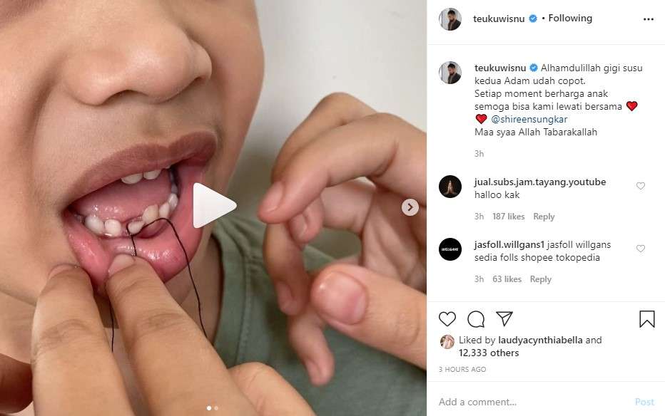 Adam anak Wisnu dan Shireen Sungkar