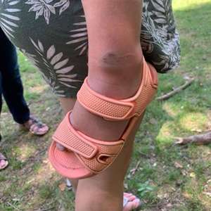 Kaki Lewis yang Digigit Ular Berbisa Kaki Lewis yang Digigit Ular Berbisa