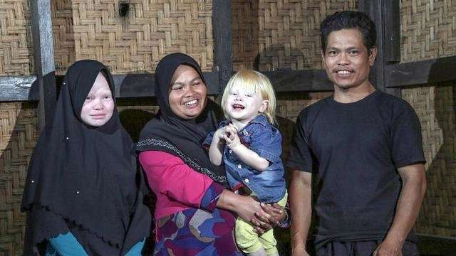 Warga Kampung Albino
