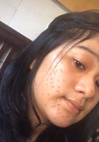 Foto diedit pakai filter jerawatan, endingnya menyedihkan