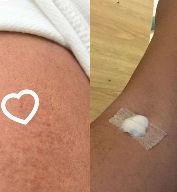 Ridwan Kamil Vaksinisasi Covid-19