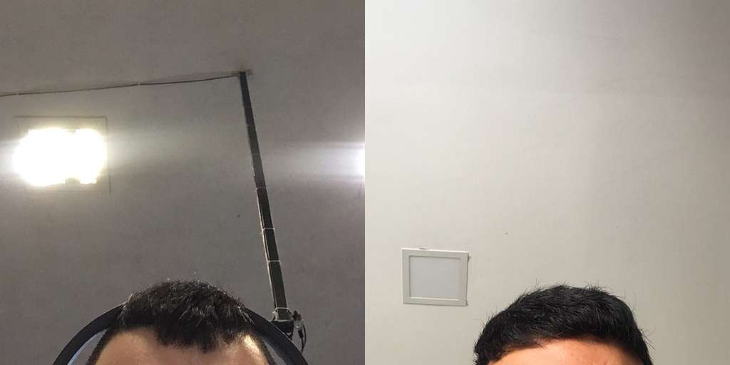 Foto dahi