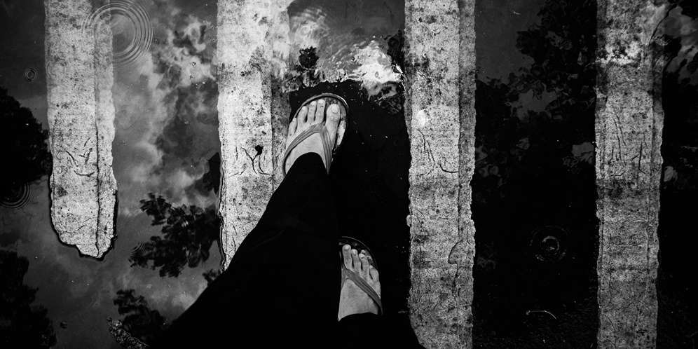 Bahaya sandal jepit jika terlalu lama digunakan
