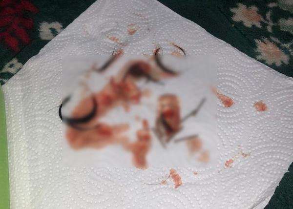 Botol kecil berisi jarum emas, helai rambut dan darah kotor.