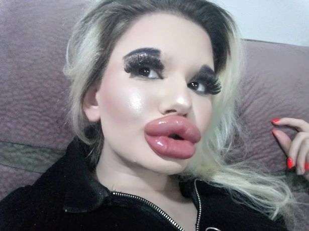Potret Andrea dengan bibir besarnya