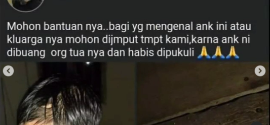 Viral