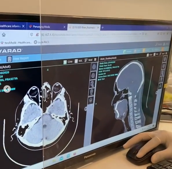 Hasil CT Scan Anjasmara