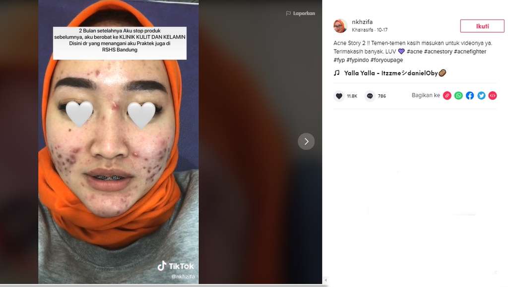 Viral teller bank
