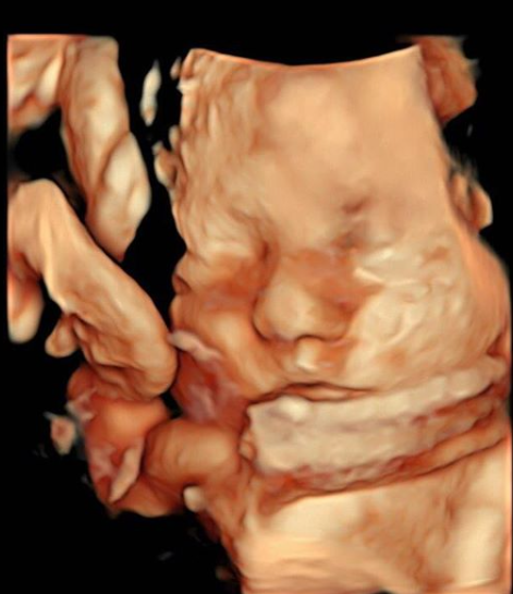 Hasil USG bayi keempat Oki Setiana Dewi