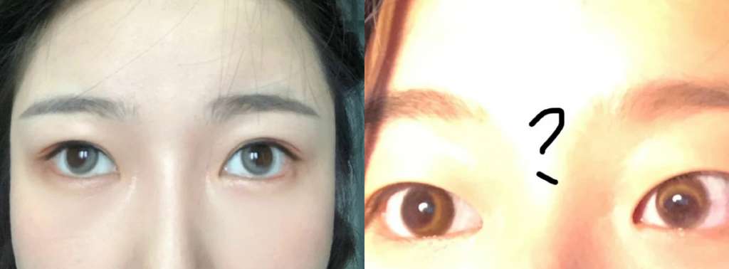 Softlens Viral