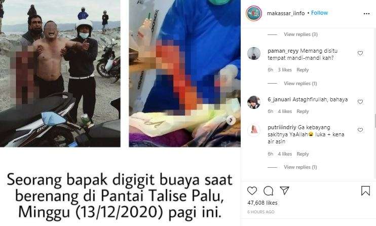 Buaya menggigit seorang pria di pantai.