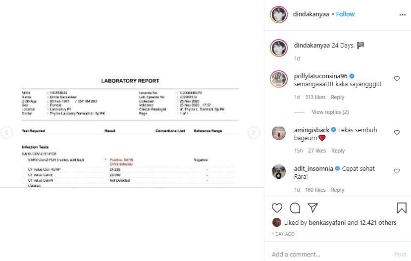 Dinda Kanya Dewi positif corona