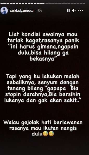 Curahatan Zaskia saat putrinya Jatuh