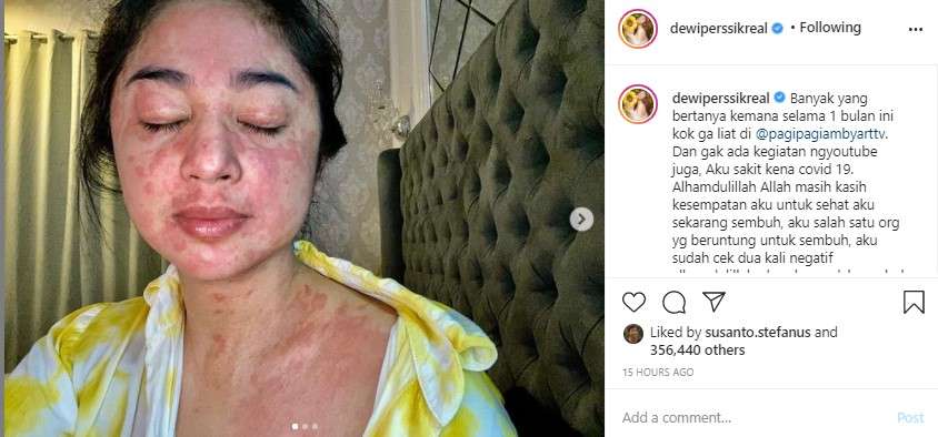 Penampakan wajah Dewi usai positif corona