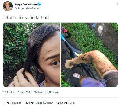 Anya Geraldine jatuh dari sepeda