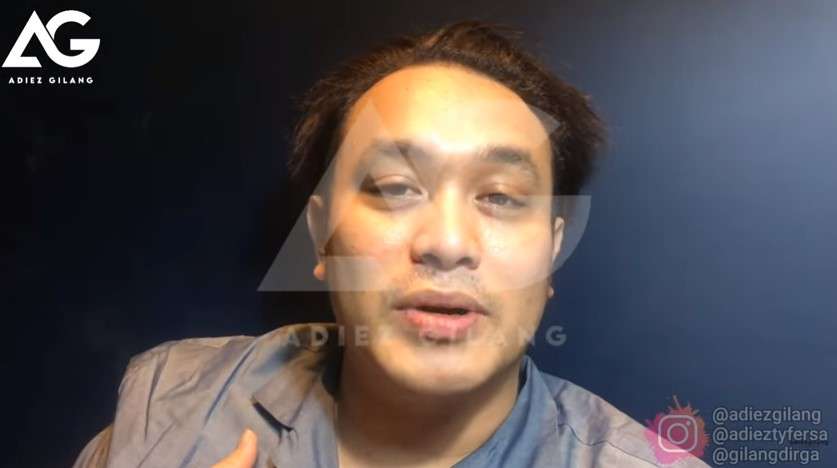 Gilang Dirga positif corona