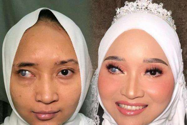 Keajaiban makeup ubah penampilan pengantin wanita dengan cacat di kanan wajahnya.