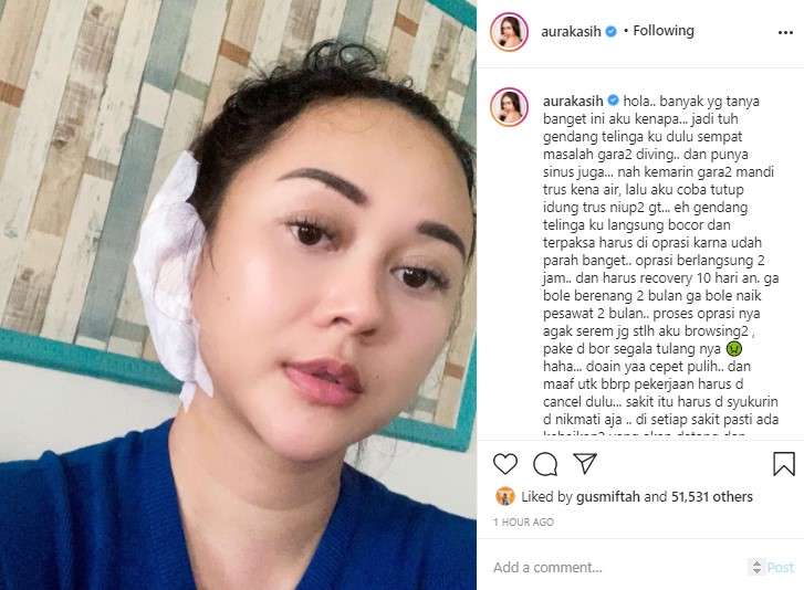 Aura Kasih menjalani operasi telinga