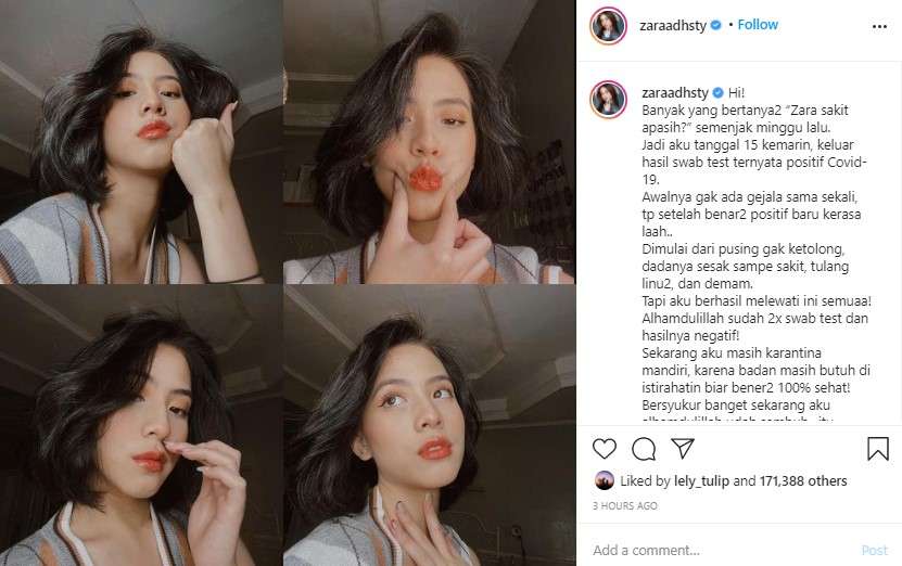 Zara eks JKT48 positif covid 19