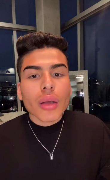 Kondisi bibir Jerry setelah dioles krim pembesar alat vital.