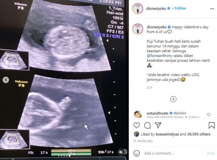 Unggahan Dion Wiyoko