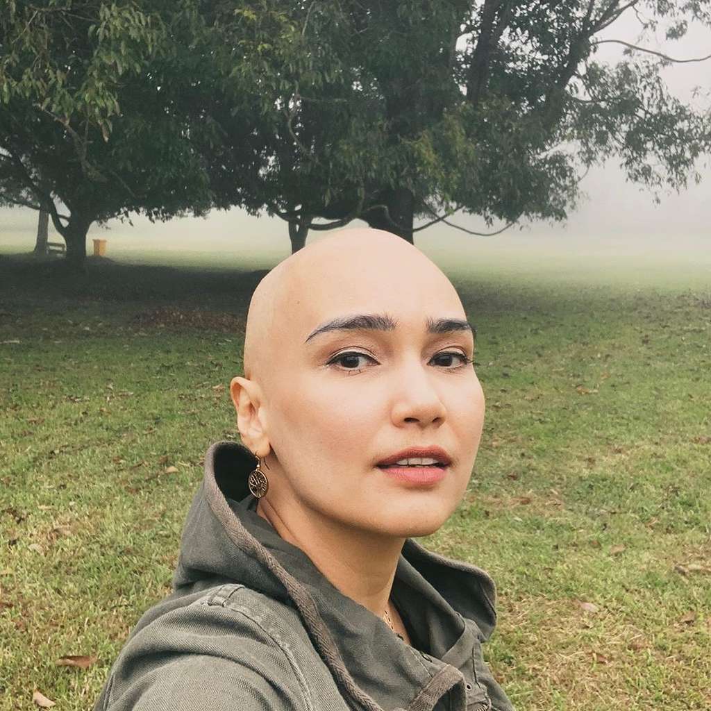 Seleb Sembuh dari Kanker