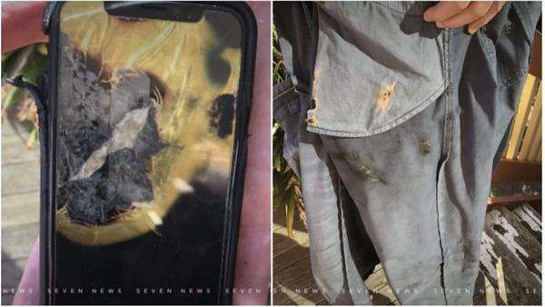Kondisi baju dan celana Robert yang hangus dan berlubang.