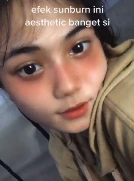 Efek sunburn yang estetik banget.