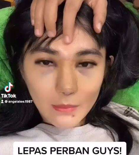 angela