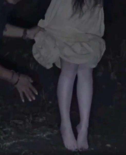 Kukunya hitam, kakinya pucet banget.