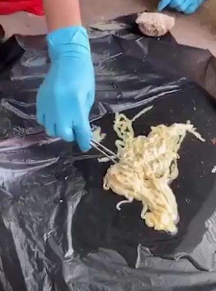 Bongkahan cacing pita yang keluar dari dubur pria Thailand.