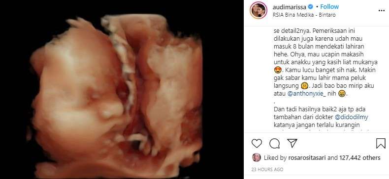 calon anak Audi Marissa  dan Anthony Xie