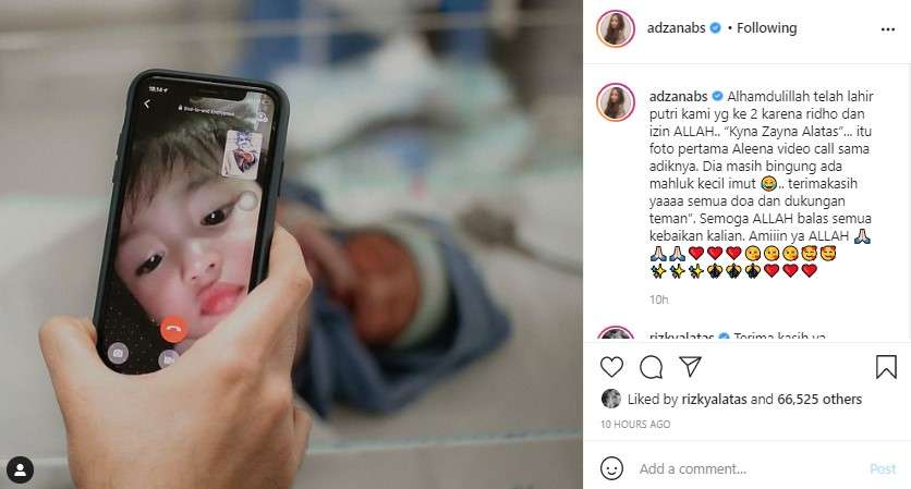 Adzana Bing Slamet dan Rizky Alatas Adzana Bing Slamet dan Rizky Alatas