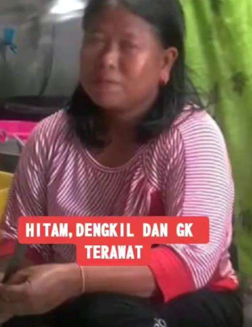 Dulu hitam dan dekil, banyak lelaki yang menjauhinya.