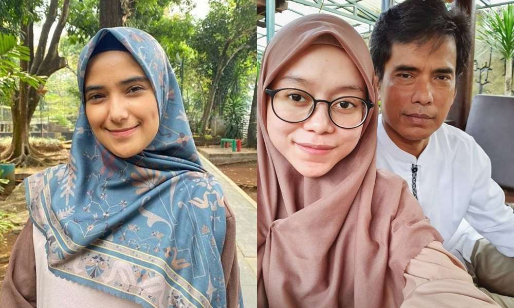 Nadya dan Lesti Tampil Cantik dengan Cara Masing-masing
