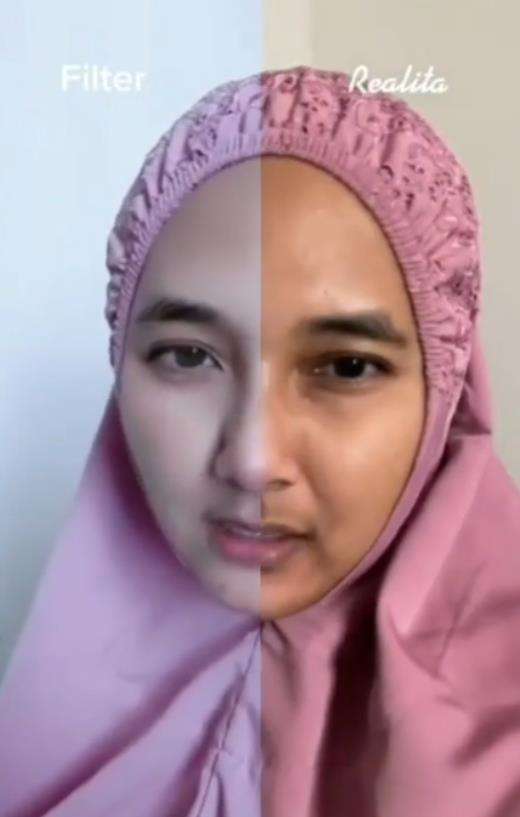 Perbedaan yang sangat menyolok.