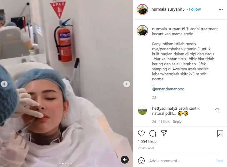 Amanda Manopo lakukan perawatan