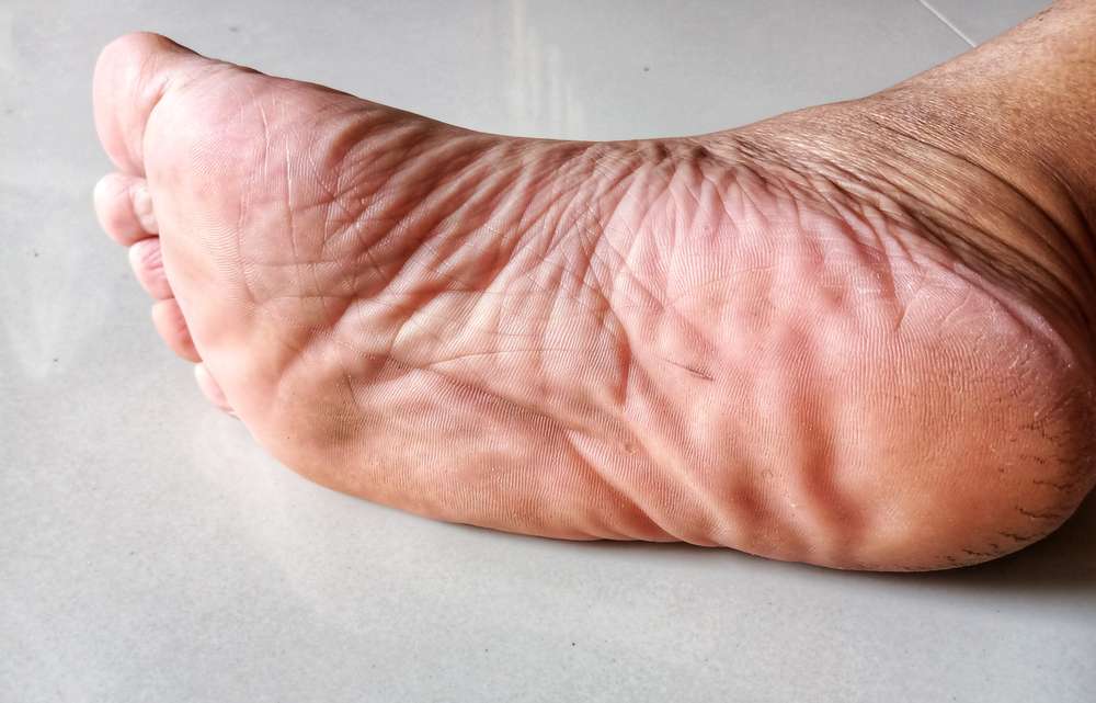 Pijat Refleksi Kaki