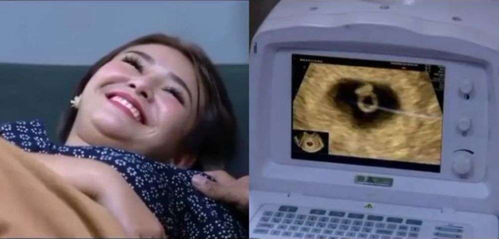Kebahagiaan saat Melihat Hasil USG