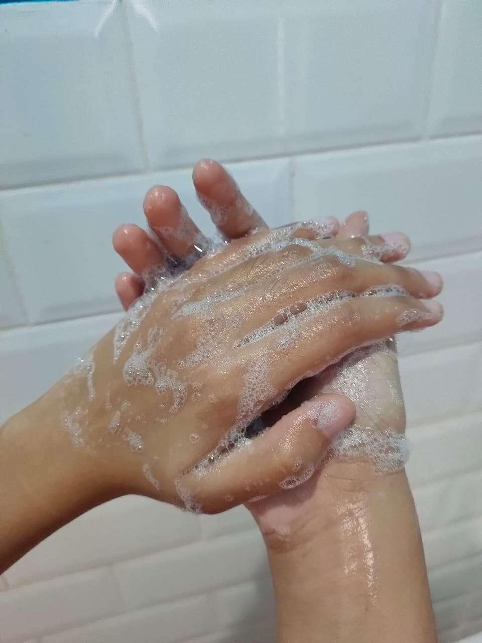 Skin Junkie
